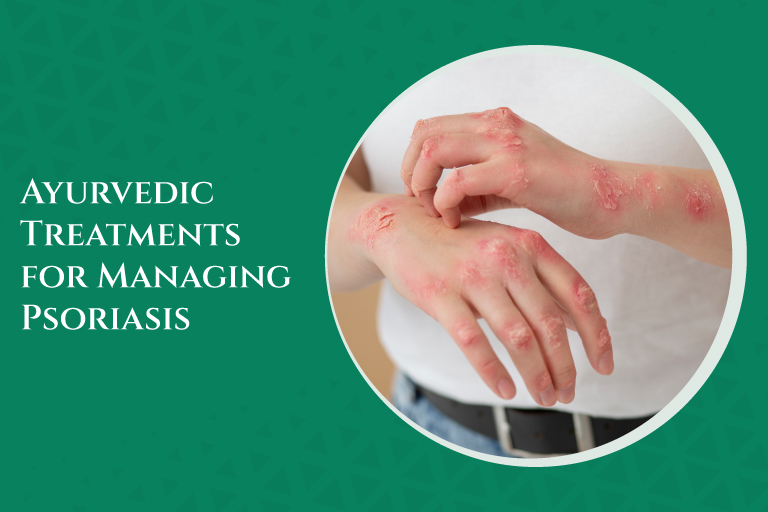 Ayurvedic Treatments for Managing Psoriasis