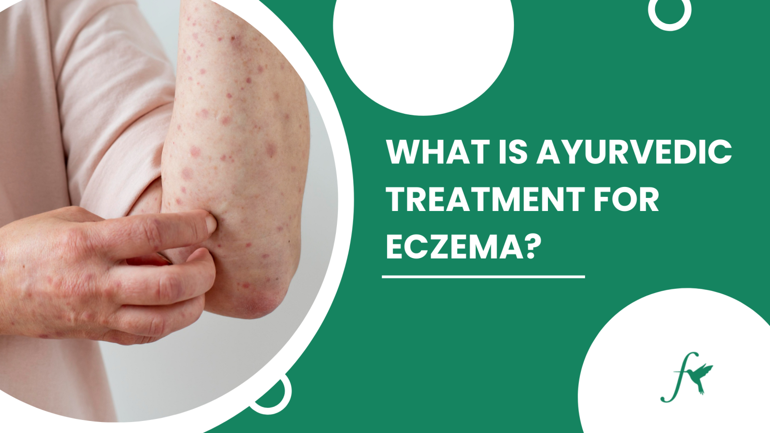 What Is Ayurvedic Treatment For Eczema?