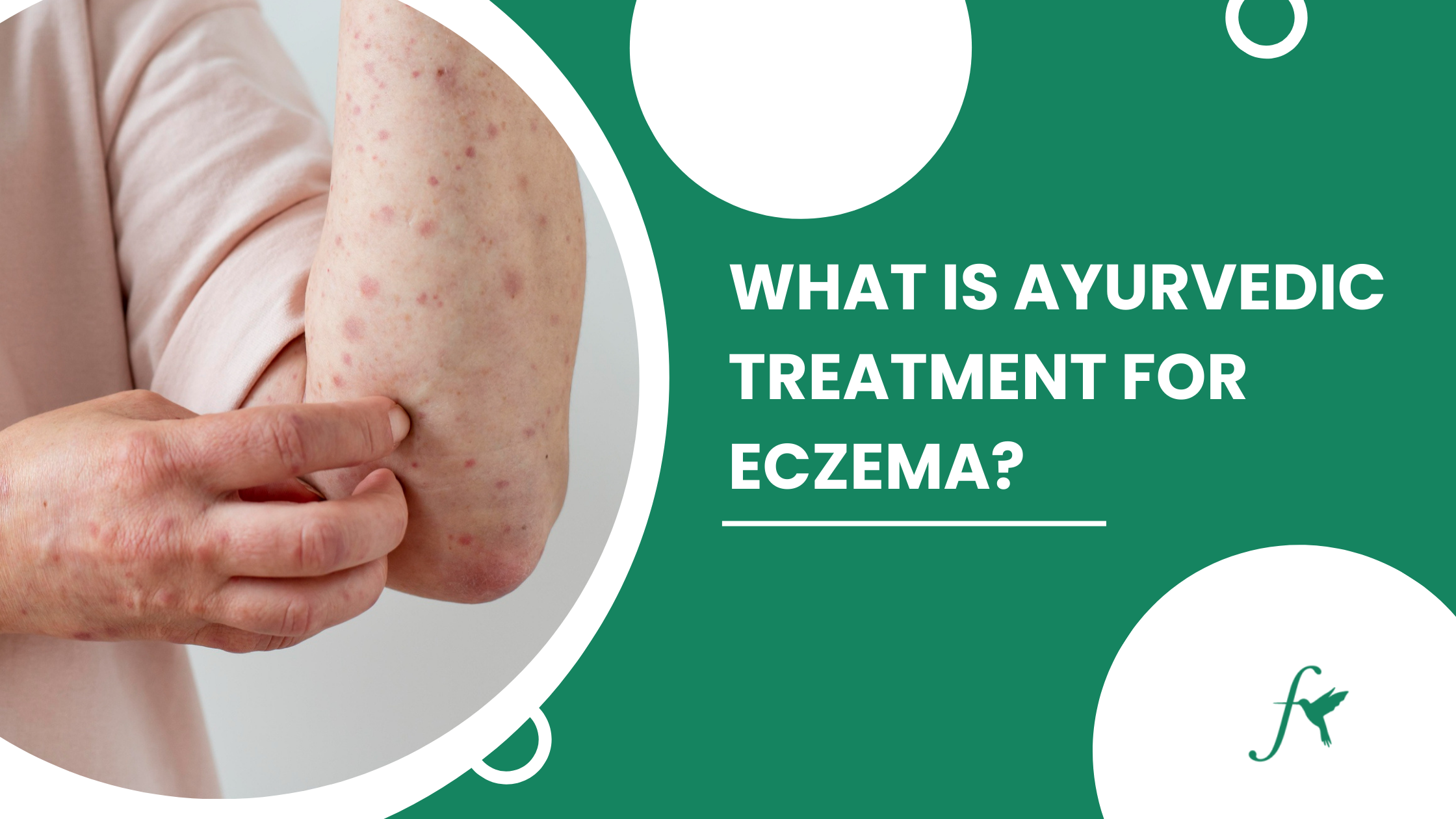 Ayurvedic Treatment For Eczema