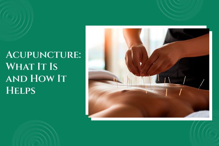 Naturopathy Acupuncture