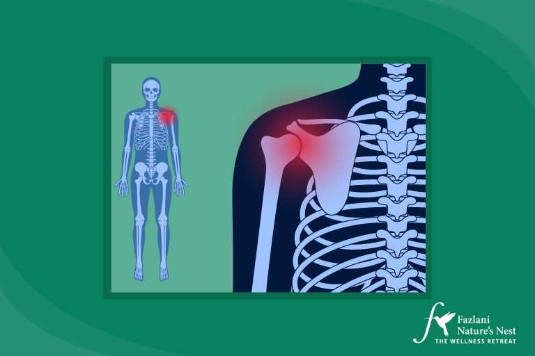 What is Frozen Shoulder and How Can Naturopathic Approaches Help