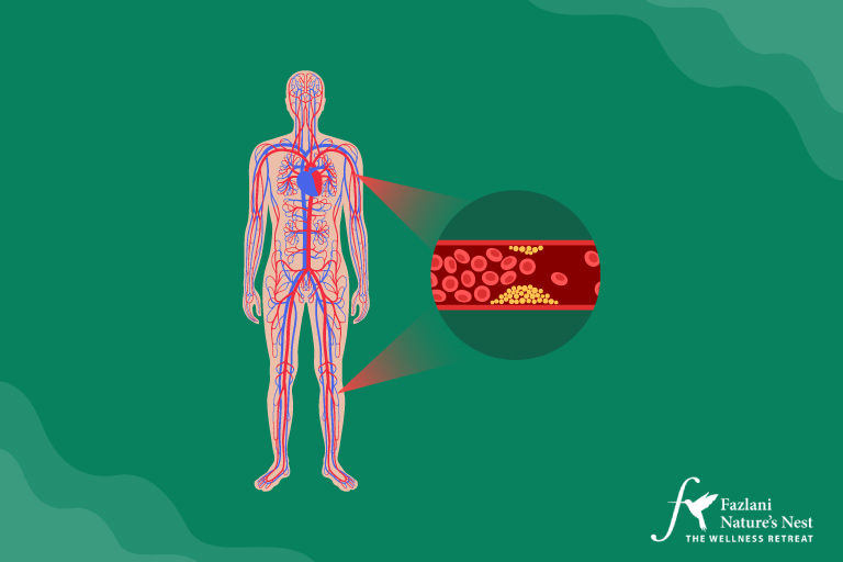 Naturopathic Remedies for Dyslipidemia